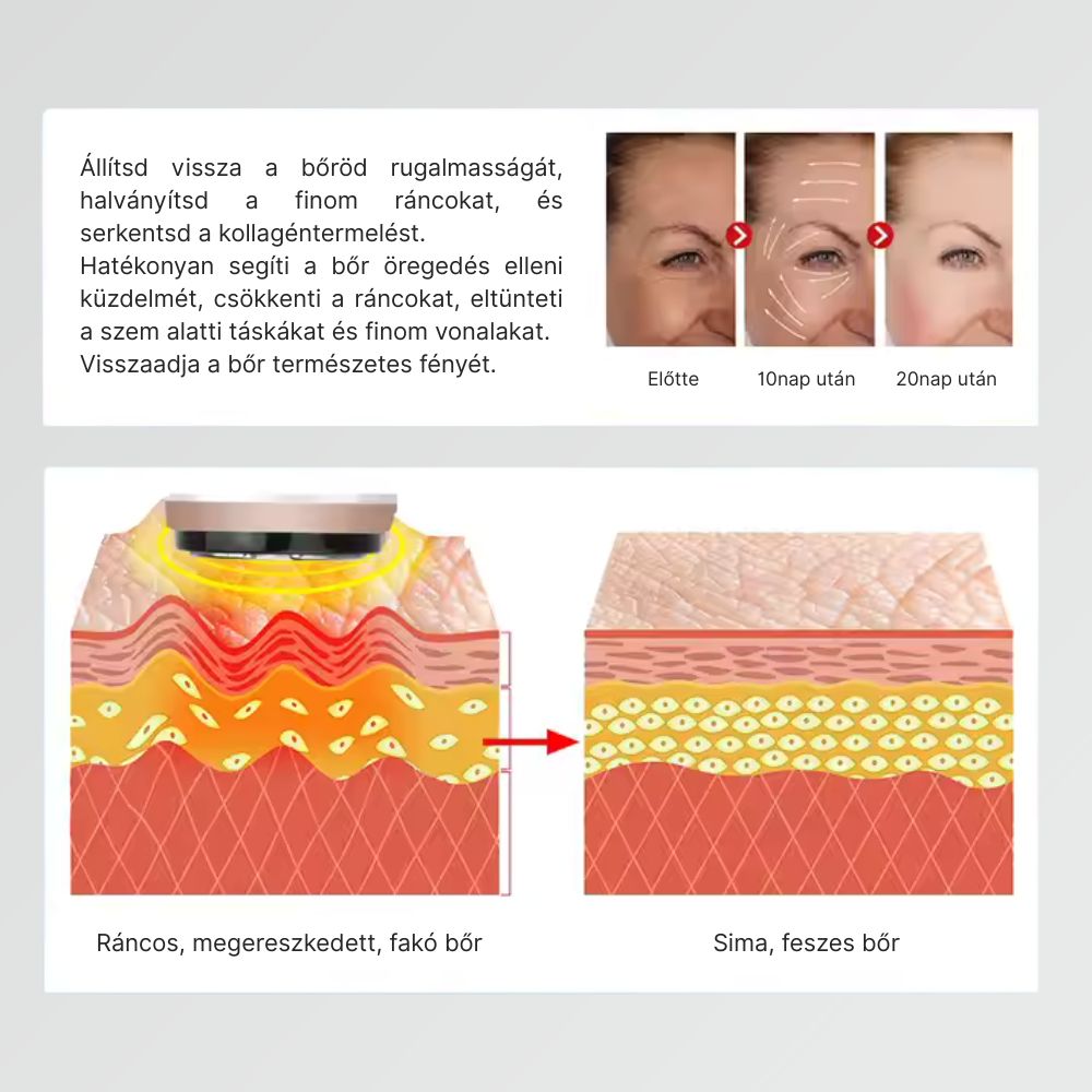 4 az 1-ben Hifu rádiófrekvenciás gép